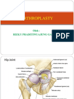 Artroplasty Hip