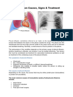 Pleural Effusion.pdf