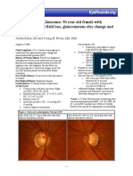 86 Normal Low Tension Glaucoma PDF