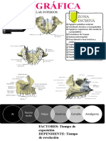 ANATOMÍA RADIOGRÁFICA - Maxilar Superior