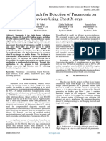 A Novel Approach For Detection of Pneumonia On Edge Devices Using Chest X-Rays