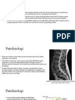 Spondylosis Lumbal