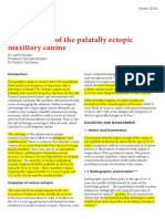 Management of The Palatally Ectopic Maxillary Canine PDF