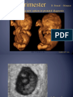 3D: An Exciting New Option in Prenatal Diagnosis