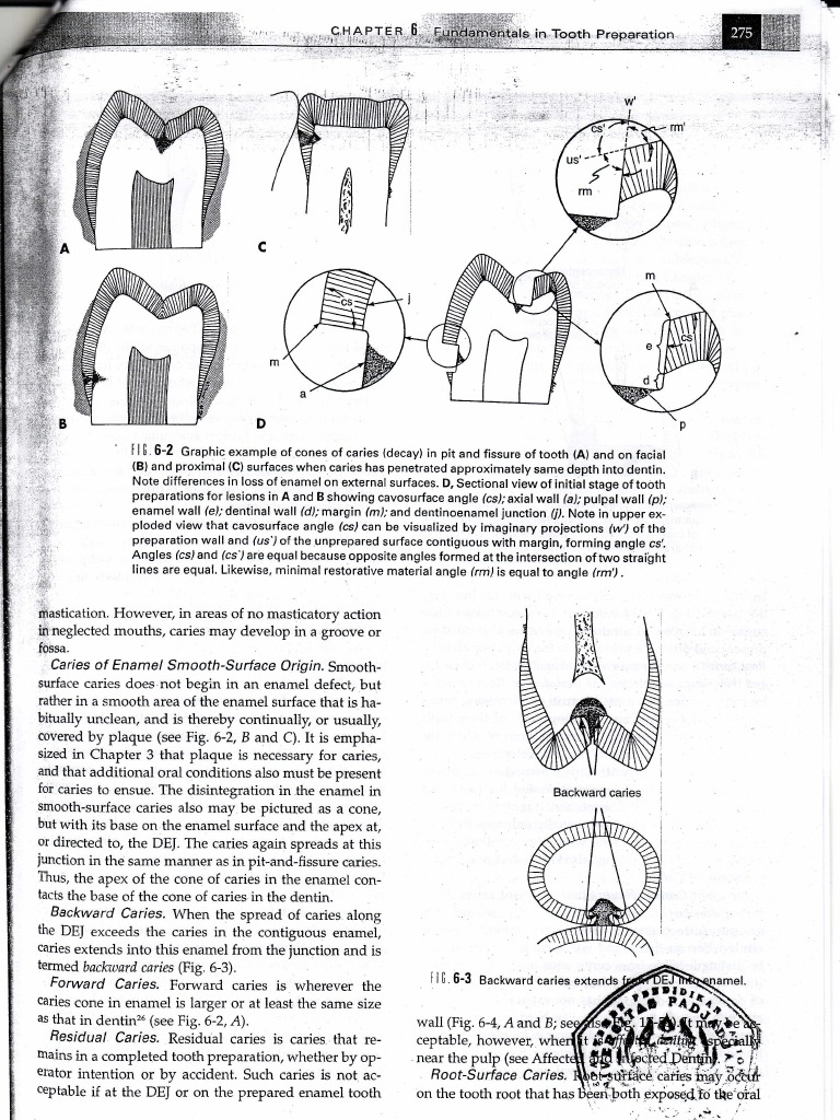 Understanding Tooth Decay Types | PDF | Tooth Enamel | Animal Anatomy