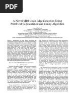 A Novel MRI Brain Edge Detection Using PSOFCM Segmentation and Canny Algorithm