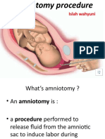 Amniotomy Record1
