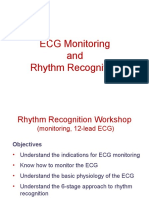 ECG Monitoring and Rhythm Recognition