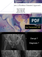 ICL Acetabular FX