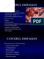 Cancerul Esofagian: Prevalenţă