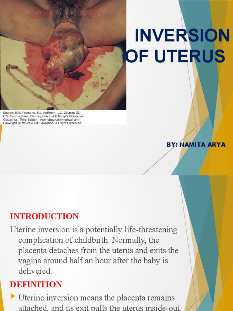 Inversion Of Uterus Pdf Uterus Shock Circulatory