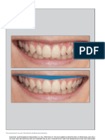 Analisis Faciales PDF