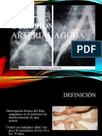 Oclusion Arterial Aguda (Clase)