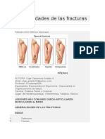 Generalidades de Las Fracturas