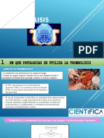 Seminario Trombolisis