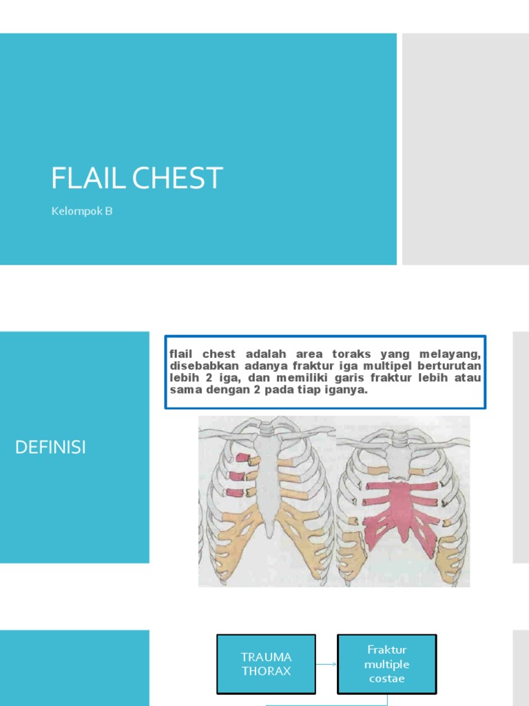Penanganan Flail Chest dan Patofisiologi | PDF