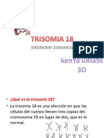 Trisomia 18