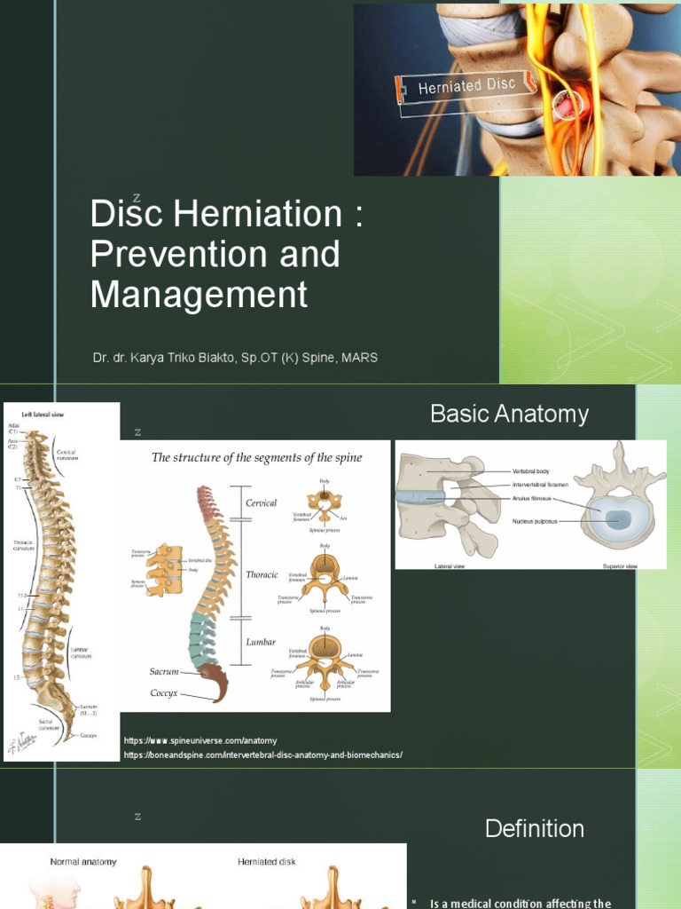Disc Herniation: Prevention & Treatment | PDF | Science & Mathematics