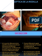 ARTRITIS SEPTICA DE LA RODILLA