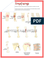 Fracturas PDF