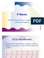 P Waves: Fast & Easy Ecgs - A Self-Paced Learning Program