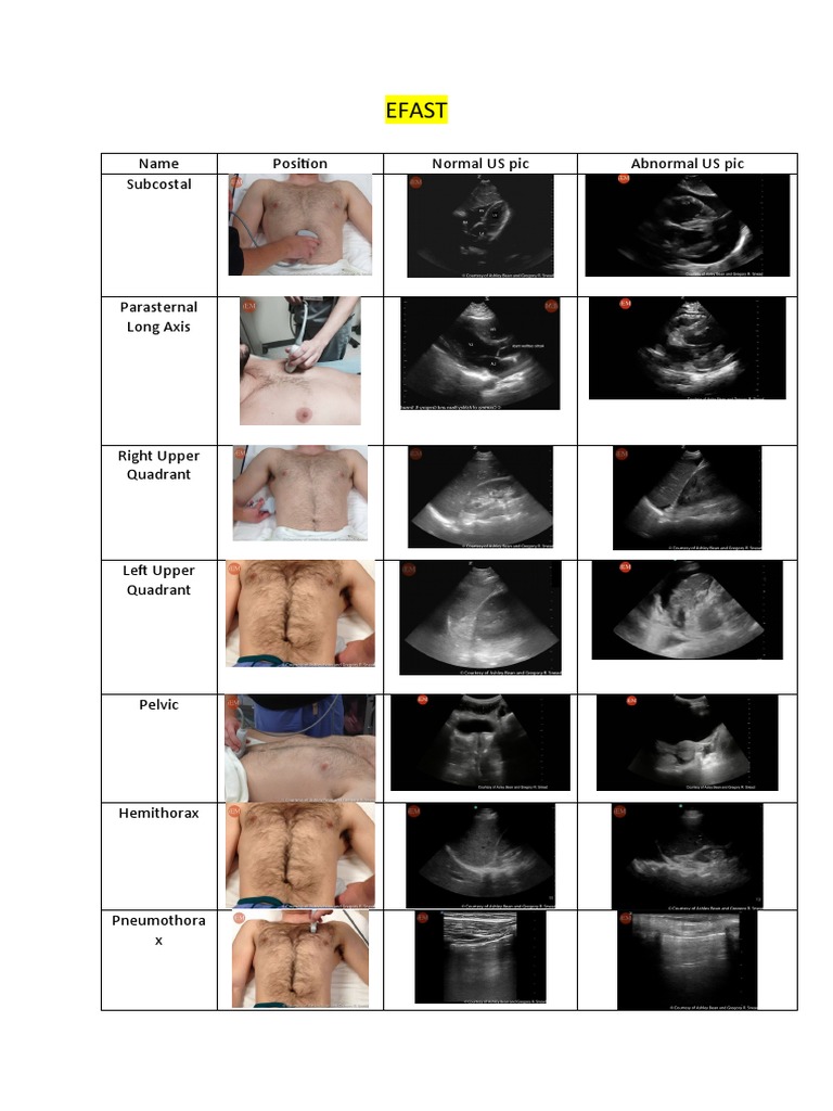 Efast: Name Position Normal US Pic Abnormal US Pic Subcostal | PDF