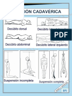 Posición Cadaverica