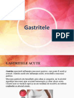 Gastrits Ulcer