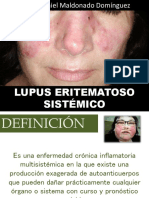 lupus eritematososistemico