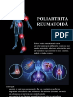 Poliartrita Reumatoida