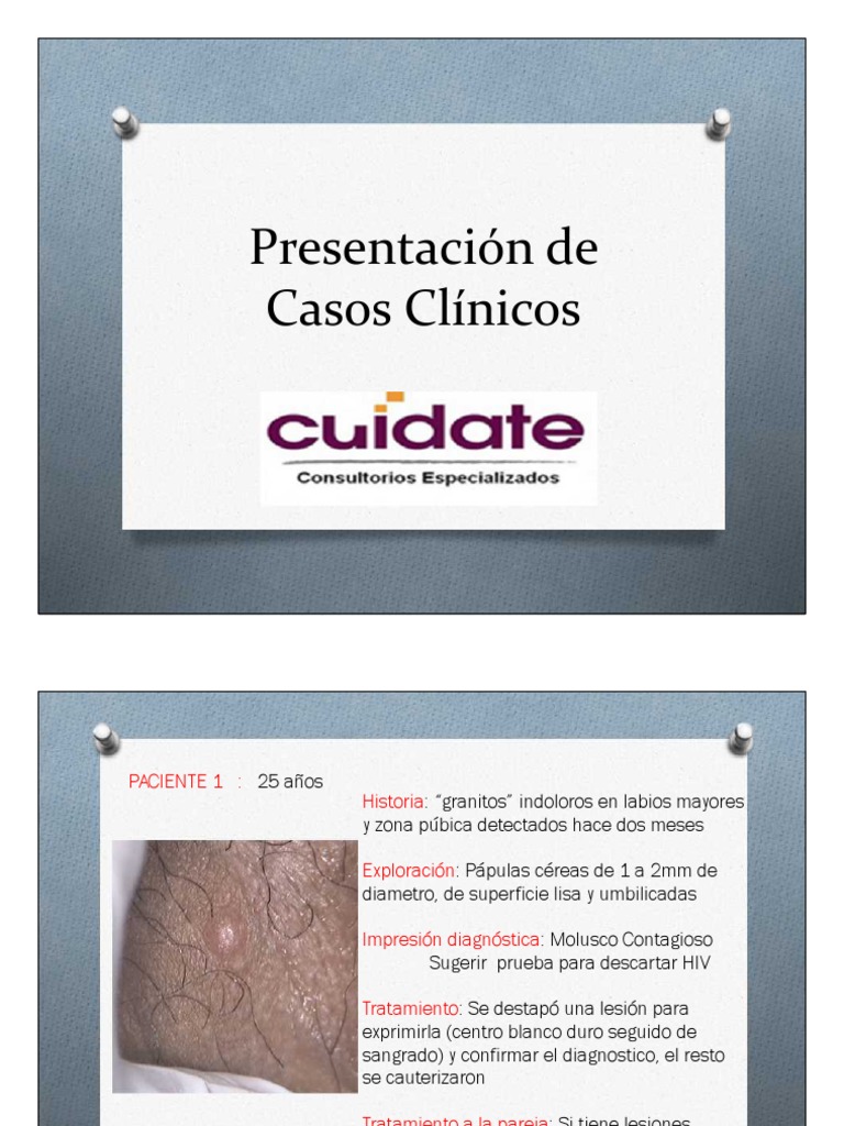 Presentación De Casos Clínicos Pdf