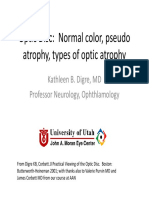 Optic Disc: Normal Color, Pseudo Atrophy, Types of Optic Atrophy