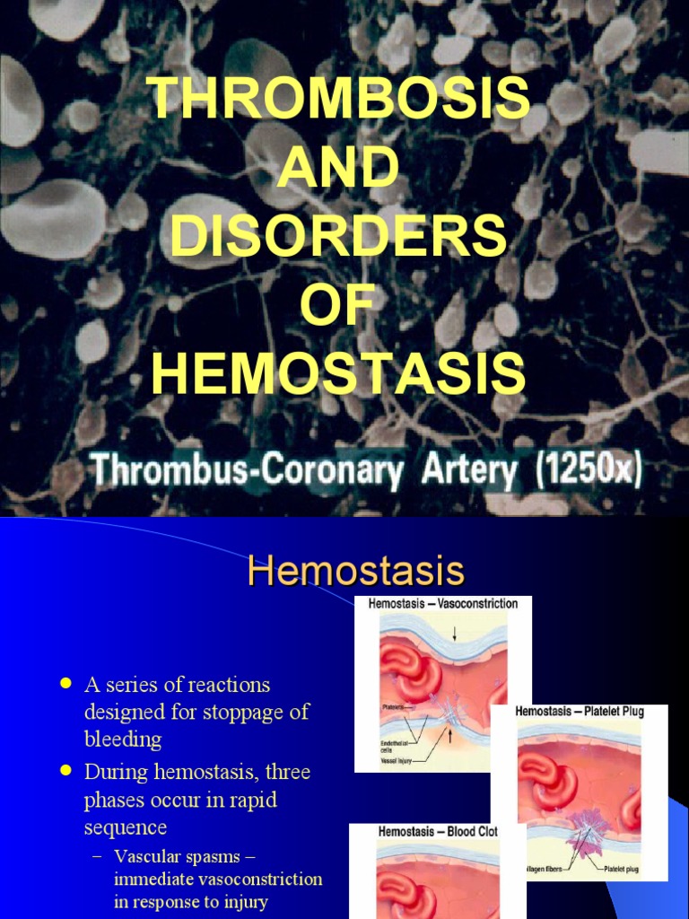 Thrombosis AND Disorders OF Hemostasis | PDF | Coagulation | Thrombus