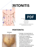 PERITONITIS