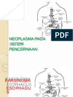 PDF Neoplasma Pada Sistem Pencernaan Esophagus Dan Kolorektal
