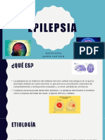 Epilepsia