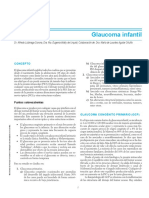 Glaucoma Infantil