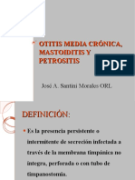 Otitis media crónica, mastoiditis y petrositis: definición, clasificación, fisiopatología, complicaciones y tratamiento