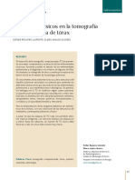 Bases de La Radiografía de Tórax PDF