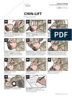 Head-Tilt/Chin-Lift: DO NOT Use If A Spinal or Neck Injury Is Suspected