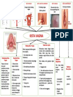 Kista Vagina