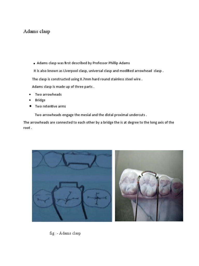 Adams Clasp | PDF | Dentistry Branches | Mouth