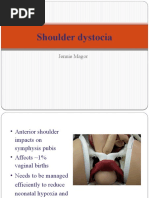 Shoulder Dystocia