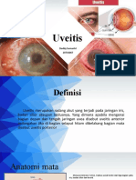 Uveitis