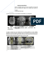 Protocolo RM Hipófisis