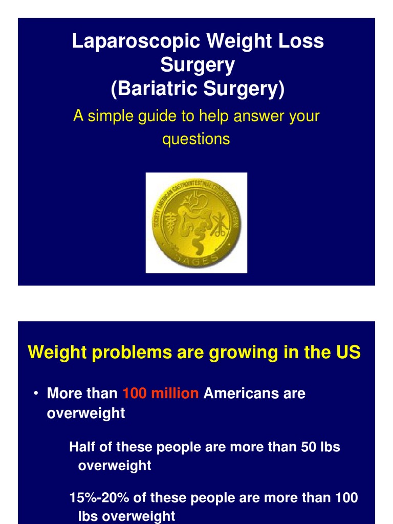 Laparoscopic Weight Loss Surgery (Bariatric Surgery) : A Simple Guide ...