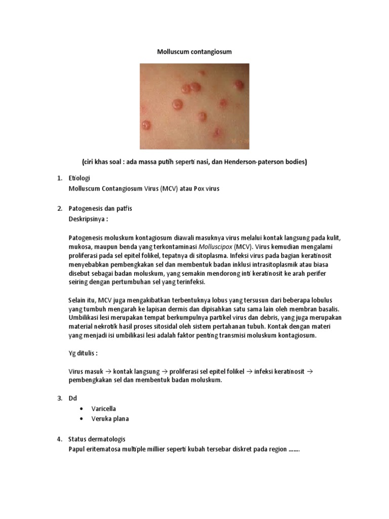 Molluscum Contangiosum | PDF