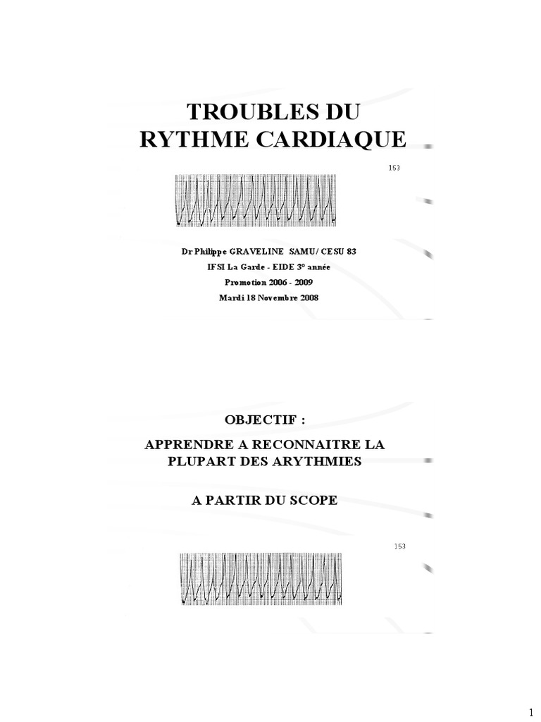 Reconnaissance des troubles du rythme | PDF | Cardiologie | RTT