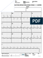 Informe ECG