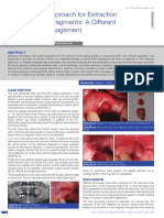 The Window Approach For Extraction of Tooth Root Fragments: A DifSoft Tissue Management
